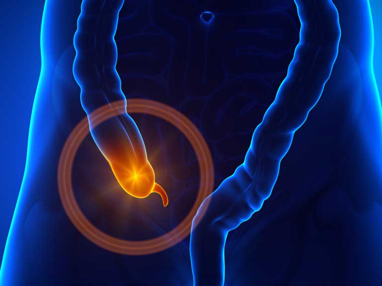 appendix
