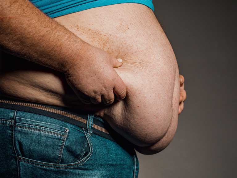obese man